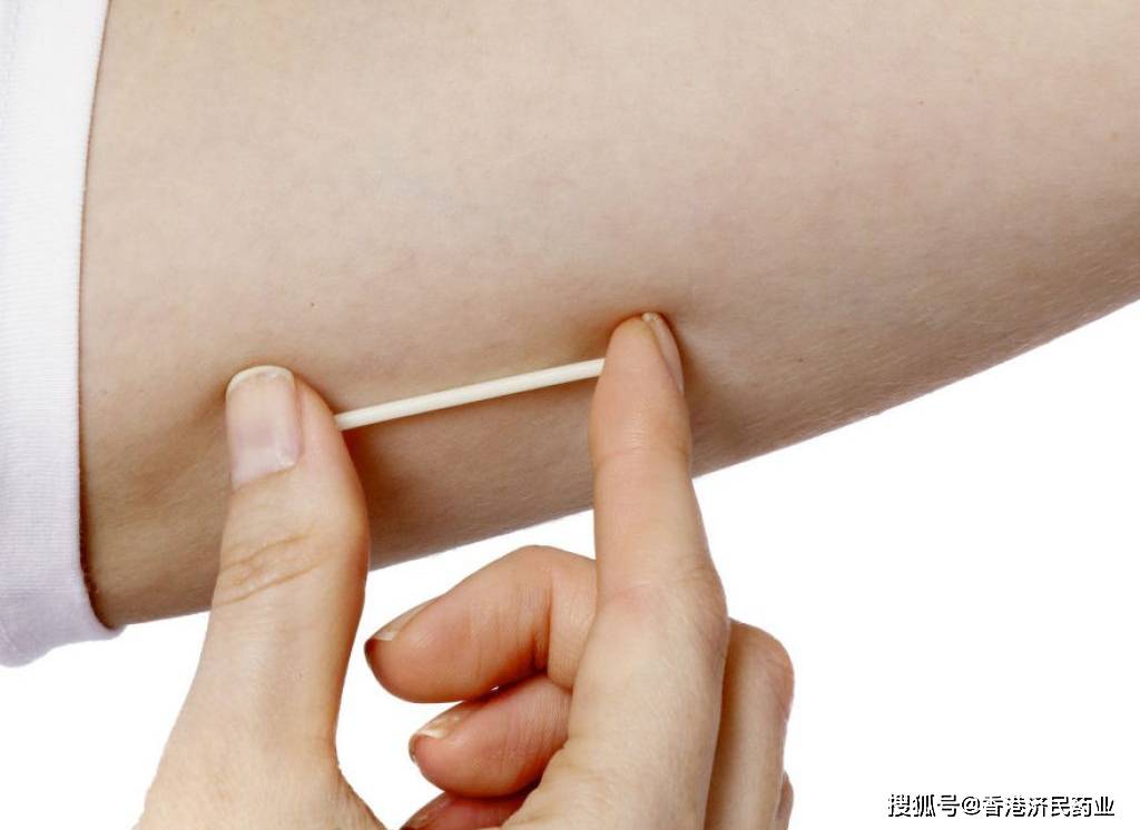 避孕植入物Nexplanon使用期限延长至5年