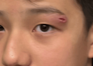 知名女演员深夜向儿子道歉：我一失手，他缝了四针……