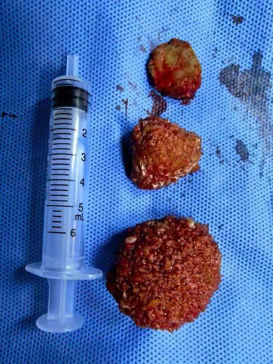 男子一天起码换三次内裤！医生：20多年都很少碰到，这个习惯可能你也有