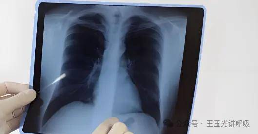 警惕！肺从软糖变饼干，这个“沉默杀手”正悄悄盯上你！