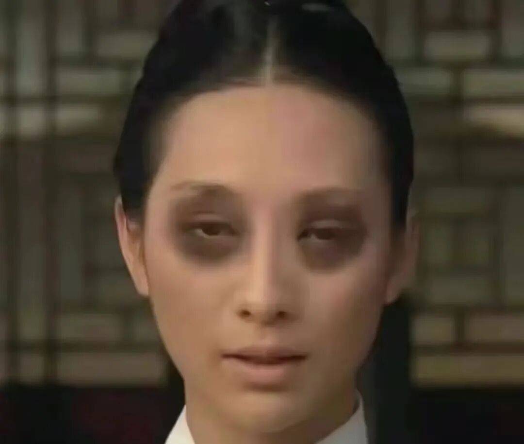 南京小伙视力骤降近乎暴盲！这个行为你也有