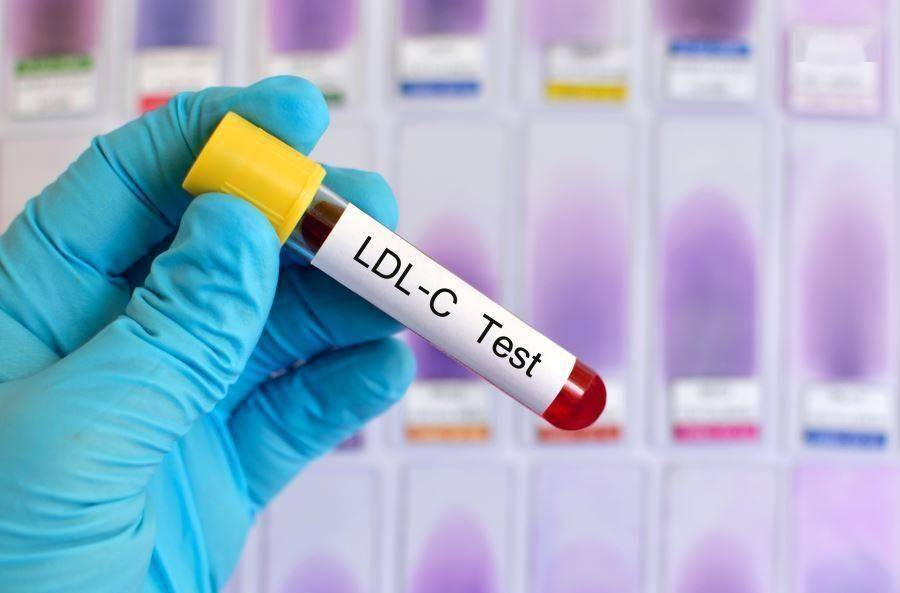 血脂需要高到多少，才需要服用他汀类药物？医生为您讲清楚