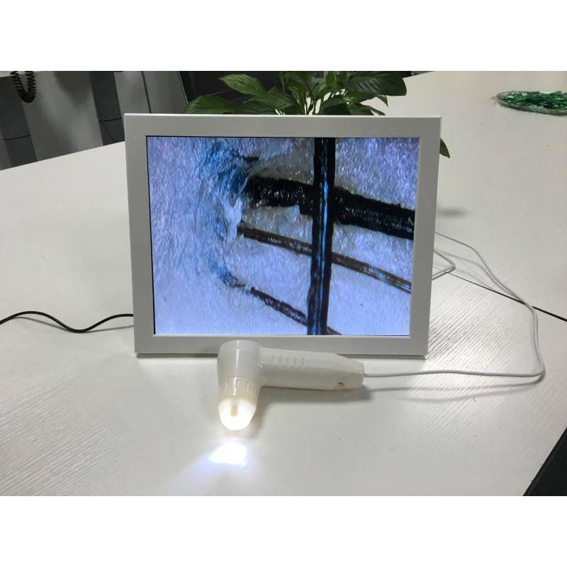 皮肤检测仪报价新款头皮检测仪毛囊皮肤检测高清便携式家用美容院养发馆检测仪器主板功能定制