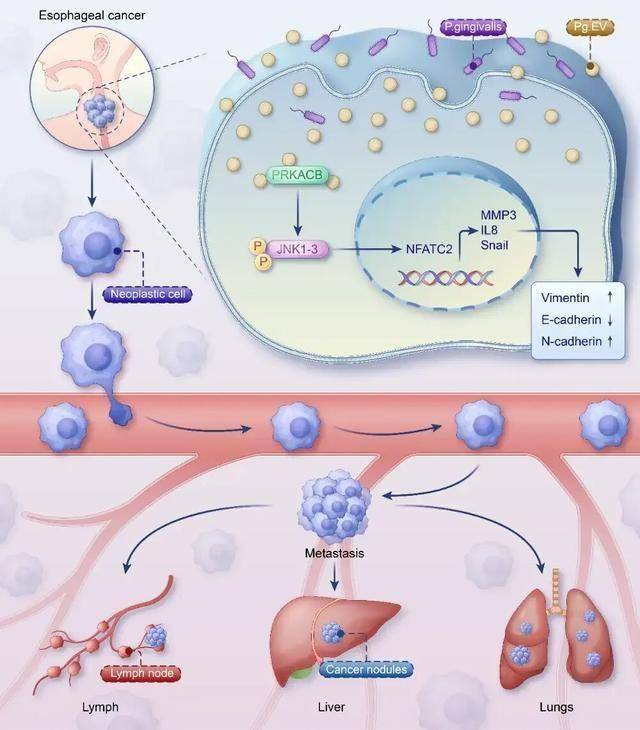 牙没刷好，竟然会助推癌细胞转移？看完立马想去刷牙！