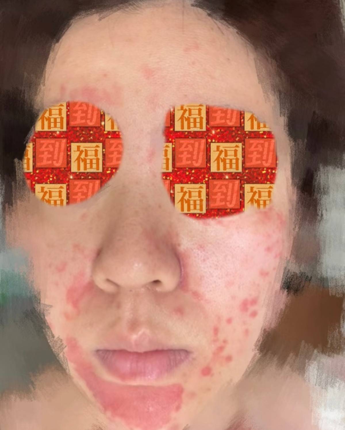 网友曝光热玛吉被烫伤，环球美天医疗美容“零差评”神话破灭！