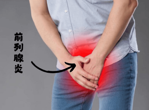 前列腺炎折磨男性，传统疗法效果差，国外草本组合争议中待选