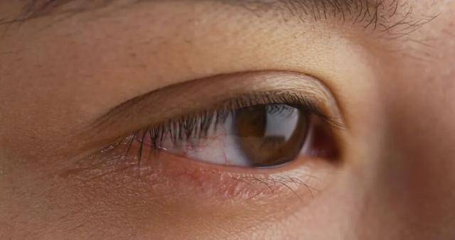 眼睛出现这两类情况，请立刻就医！