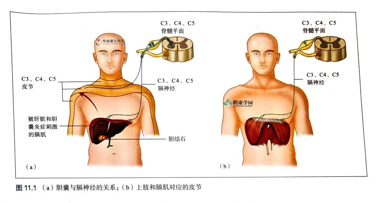 一图秒懂，为什么胆囊炎会导致右肩痛？