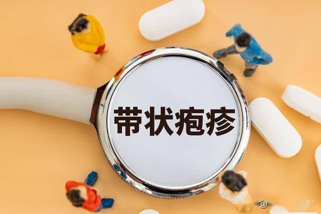 带状疱疹分3型辨证调理，3种经典中成药对症选用，降低后遗痛风险