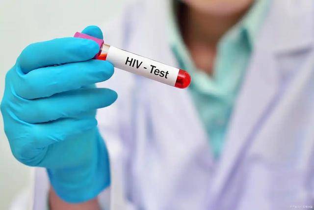 原创            人有没有艾滋病，看嘴巴就知？医生：有艾滋的人，嘴巴5种表现