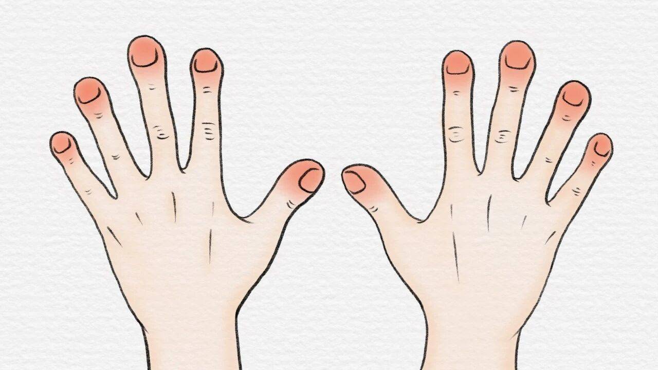 原创            肺癌来临，双手先知！提醒：双手出现这4个变化，可能是肺受损了