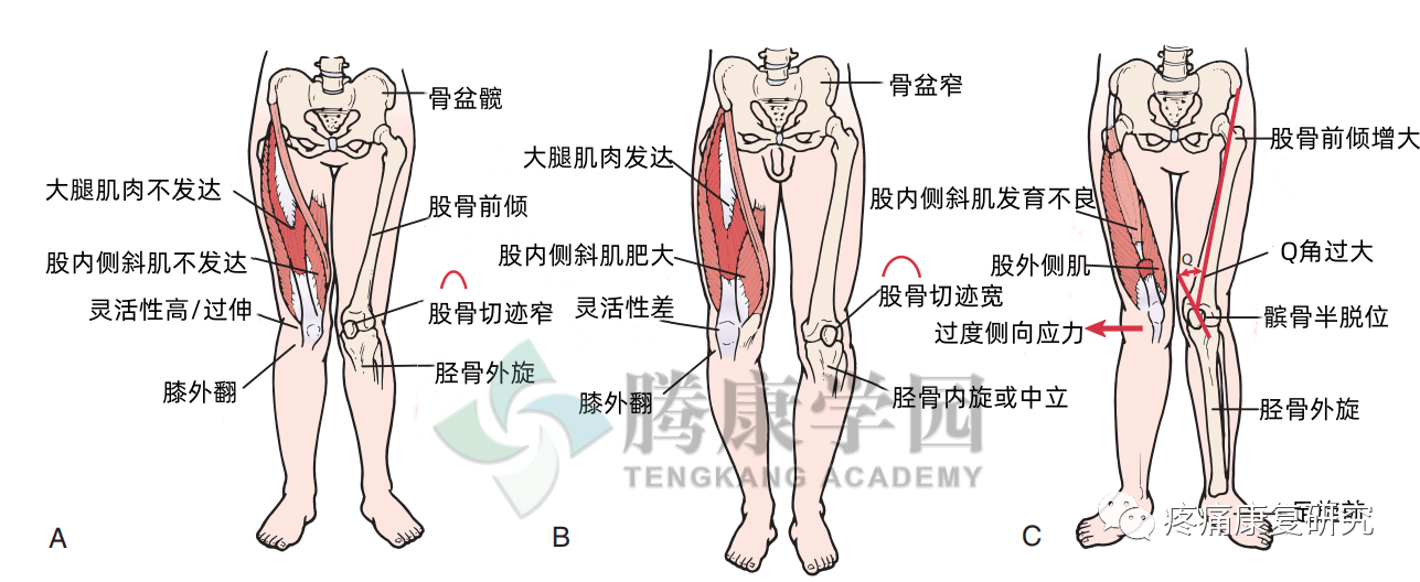 一图学习，男女下肢力线分析